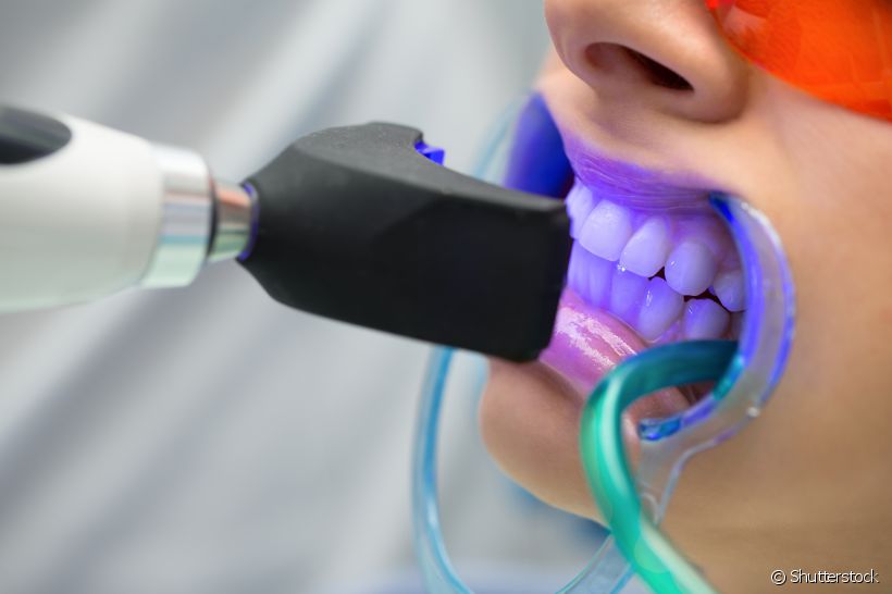 Como funciona o Clareamento Dental